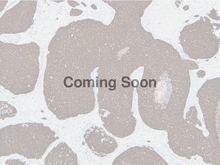 Load image into Gallery viewer, Cytokeratin 10