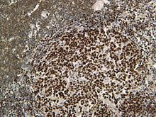 Load image into Gallery viewer, Feline lymph node stained with CD3 and PAX5.