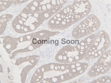 Load image into Gallery viewer, Cytokeratin LMW