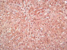 Load image into Gallery viewer, Melan A