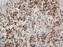 Load image into Gallery viewer, Canine lymph node stained with PAX-5, 40X