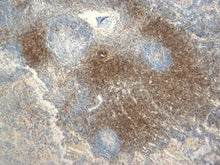 Load image into Gallery viewer, Feline lymph node stained with CD3. 10X