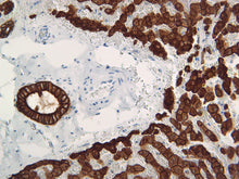Load image into Gallery viewer, Cytokeratin 18