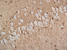 Load image into Gallery viewer, Feline brain stained with S100B