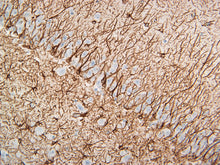 Load image into Gallery viewer, Canine brain CA3 region stained with GFAP. 40X