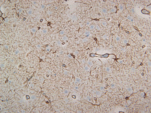 Load image into Gallery viewer, Canine cortex stained with GFAP. 40X