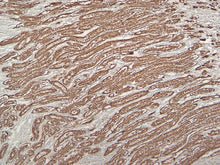 Load image into Gallery viewer, Ksp-Cadherin