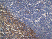 Load image into Gallery viewer, Feline lymph node stained with CD20