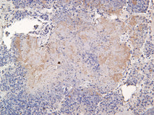 Load image into Gallery viewer, Pan Bacteria