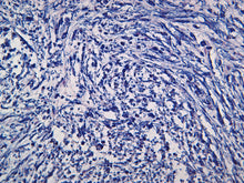 Load image into Gallery viewer, Vimentin