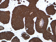 Load image into Gallery viewer, Cytokeratin 10