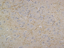 Load image into Gallery viewer, Neurofilament (NF-H)