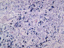 Load image into Gallery viewer, Microphthalmia-Associated Transcription Factor (MITF)