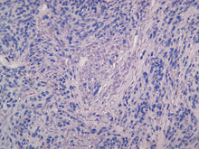 Load image into Gallery viewer, SOX10