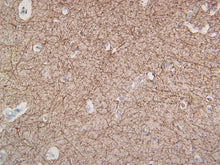 Load image into Gallery viewer, Neurofilament (NF-H)