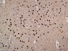 Load image into Gallery viewer, Neurofilament (NF-L)