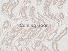 Load image into Gallery viewer, Ksp-Cadherin