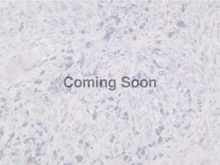 Load image into Gallery viewer, Microphthalmia-Associated Transcription Factor (MITF)