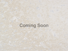 Load image into Gallery viewer, Neurofilament (NF-H)