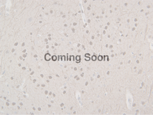 Load image into Gallery viewer, Neurofilament (NF-L)