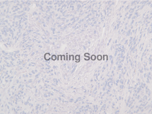 Load image into Gallery viewer, SOX10