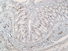 Load image into Gallery viewer, Vimentin