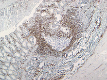 Load image into Gallery viewer, Vimentin