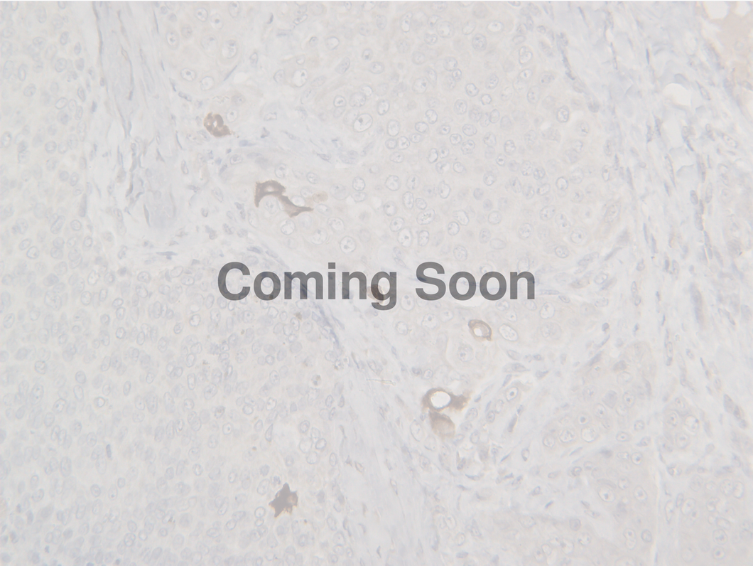 Cytokeratin 10