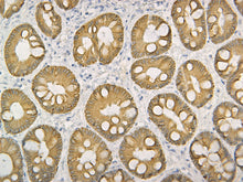Load image into Gallery viewer, Pan Cytokeratin
