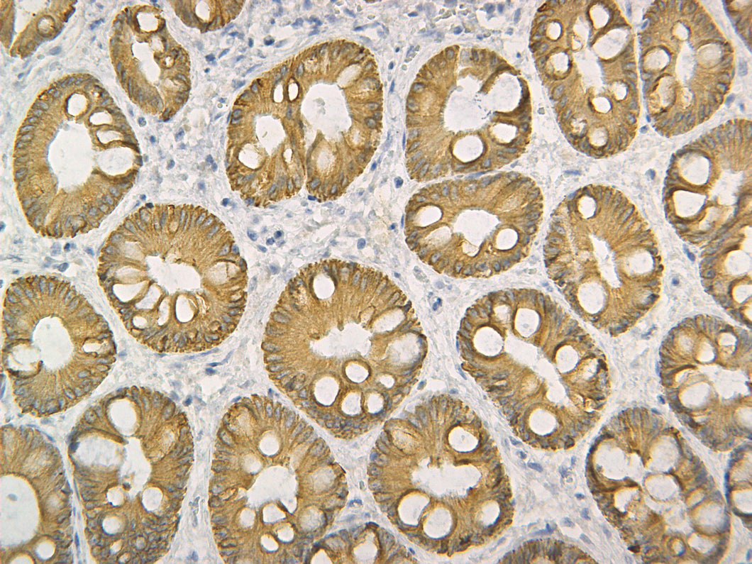 Pan Cytokeratin
