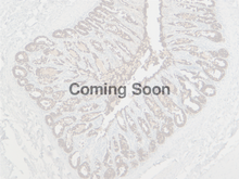 Load image into Gallery viewer, Cytokeratin 18
