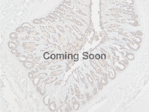 Cytokeratin 18
