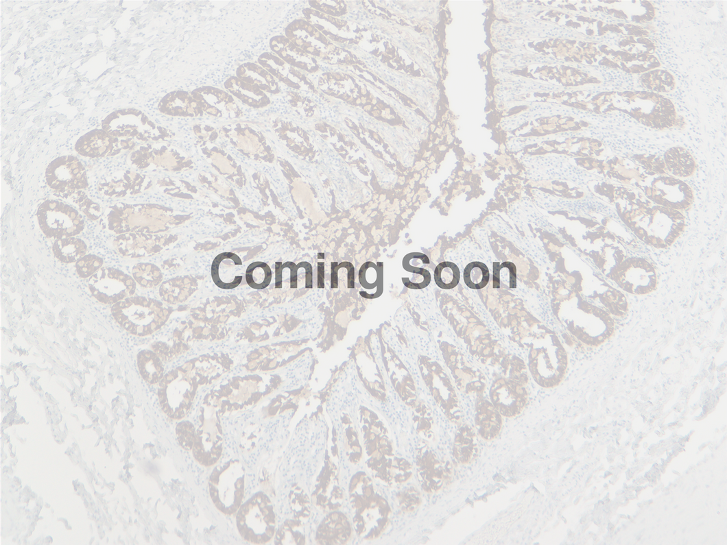 Cytokeratin 18