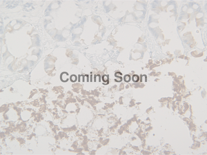 Cytokeratin 8