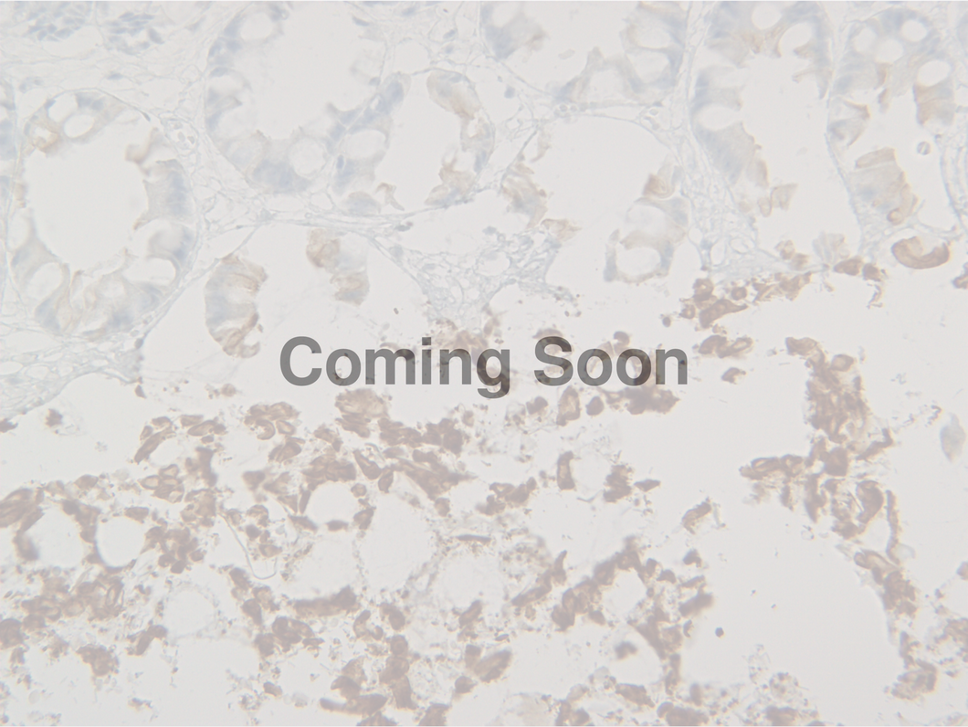 Cytokeratin 8