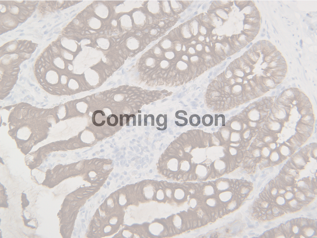 Cytokeratin LMW