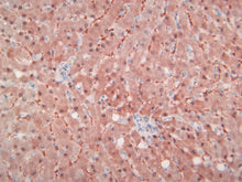 Load image into Gallery viewer, VeteMAb Melan A (Rb) [VMAB001] Dog Melanoma; 40X
