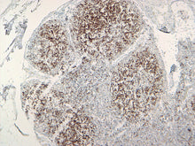 Load image into Gallery viewer, Canine lymph node stained with PAX-5, 10X
