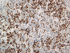 Canine lymph node stained with PAX-5, 40X