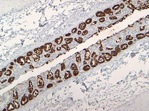 Pan Cytokeratin