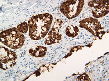 Load image into Gallery viewer, Pan Cytokeratin
