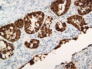 Pan Cytokeratin