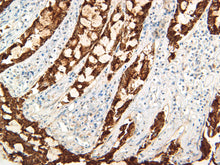Load image into Gallery viewer, Pan Cytokeratin
