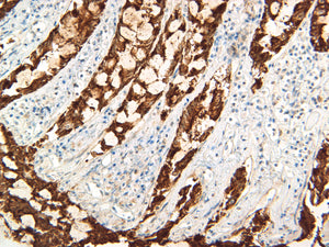 Pan Cytokeratin