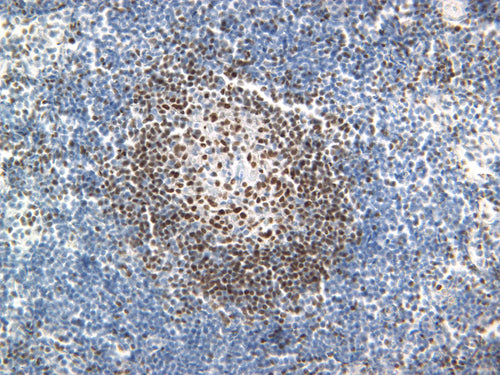 Feline lymph node stained with PAX-5, 40X