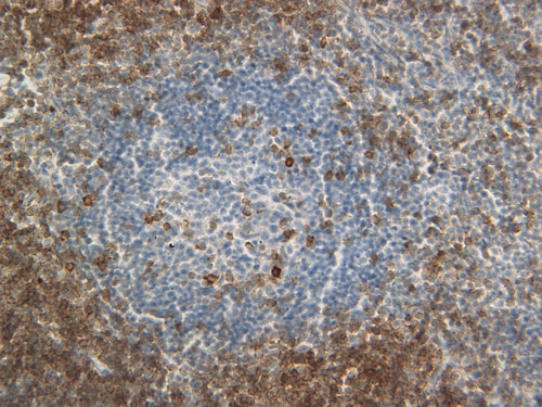 Feline lymph node stained with CD3. 40X