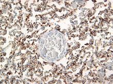 Load image into Gallery viewer, Cytokeratin 18
