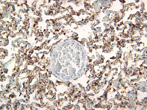 Cytokeratin 18