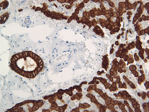 Cytokeratin 18