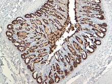 Load image into Gallery viewer, Cytokeratin 18
